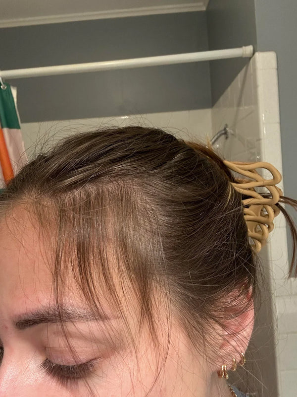 New baby hairs especially around my temples. Balding spots are less visible now.