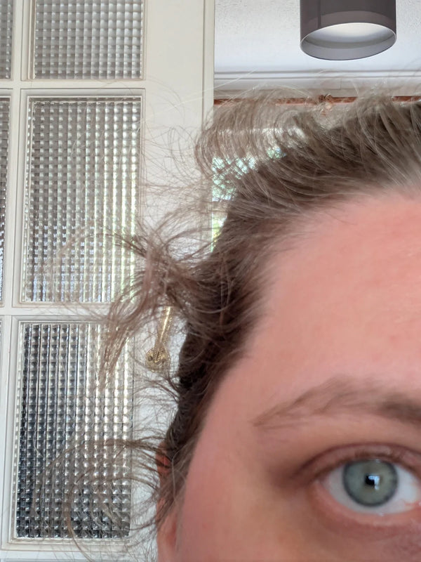 Softer, fuller, growing a bit faster. Took about 5 months but it's working.